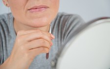 Masz ciemne włoski na brodzie? Lepiej idź do lekarza!