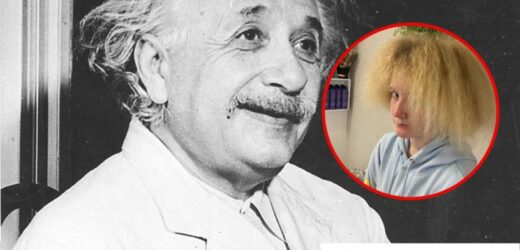 „Dziewczynka z włosami Einsteina” ma już 12 lat. Tak teraz wygląda