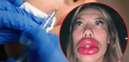 24-latka postanowiła powiększyć usta. Cudem uniknęła tragedii. „Nie polecam”