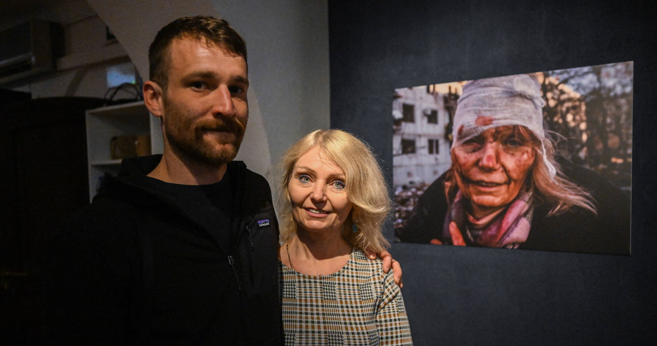 Zdjęcie-symbol. Znamy losy kobiety z zakrwawioną twarzą