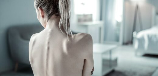 Ważyła 17 kilogramów i nie miała siły, by wstać z łóżka. Oto jak teraz wygląda