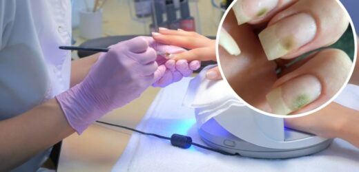 Zauważyłaś zielone plamki na paznokciach? Lepiej nie wykonuj na nich kolejnego manicure
