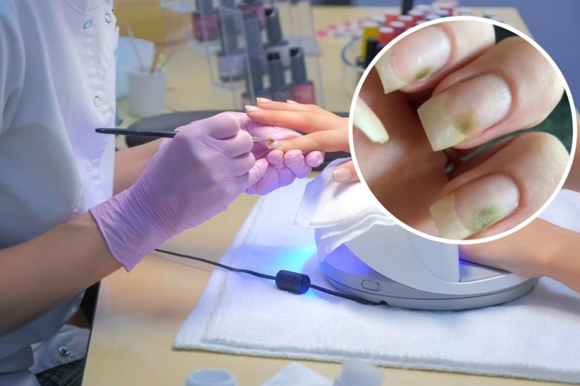 Zauważyłaś zielone plamki na paznokciach? Lepiej nie wykonuj na nich kolejnego manicure