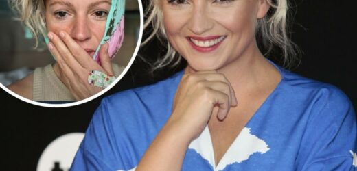 Dorota Szelągowska pokazała zdjęcie po zabiegu. „Polecam wyrywanie ósemek dzień przed tłustym czwartkiem”