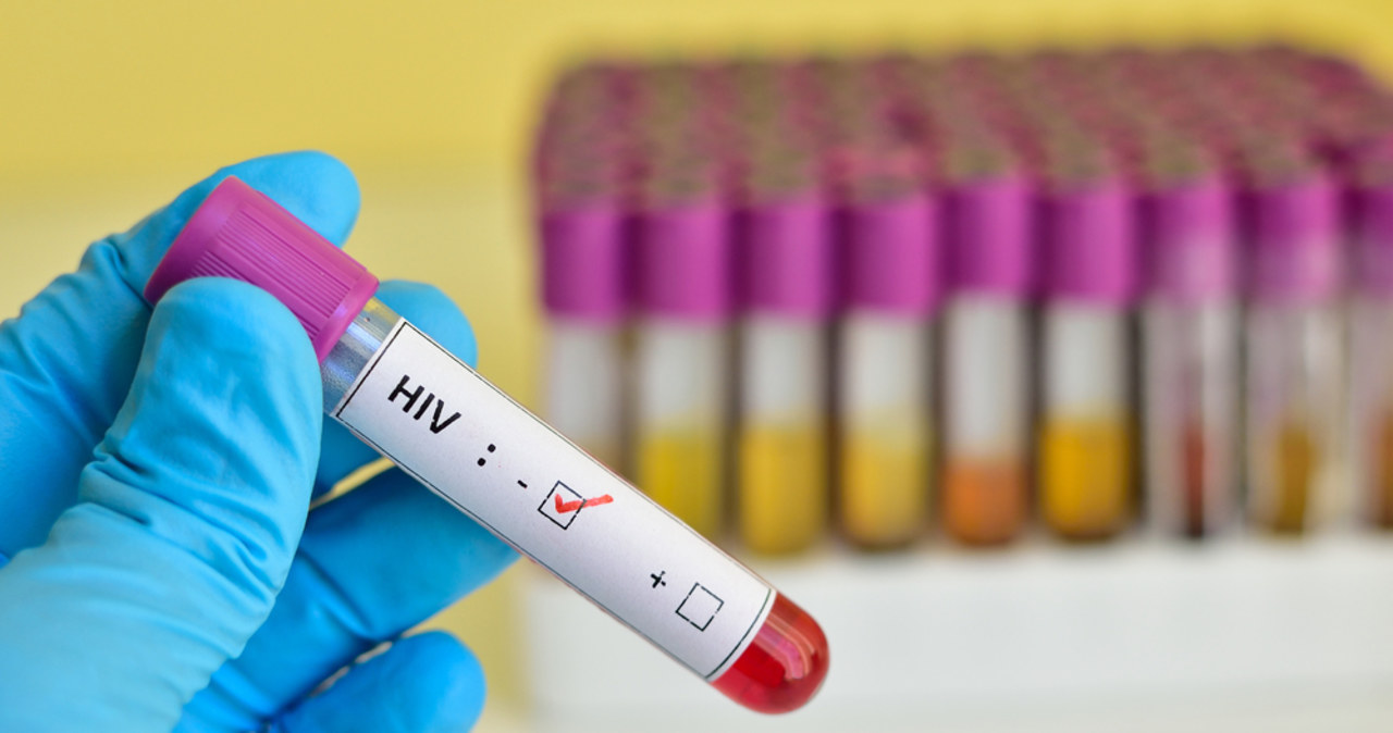 Kolejny pacjent wyleczony z HIV. Zastosowano kontrowersyjną terapię