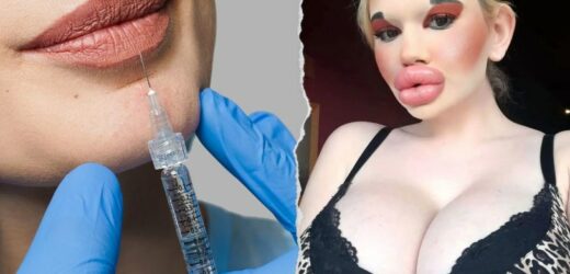 25-latka jest fanką operacji plastycznych. Jej usta są największe na świecie