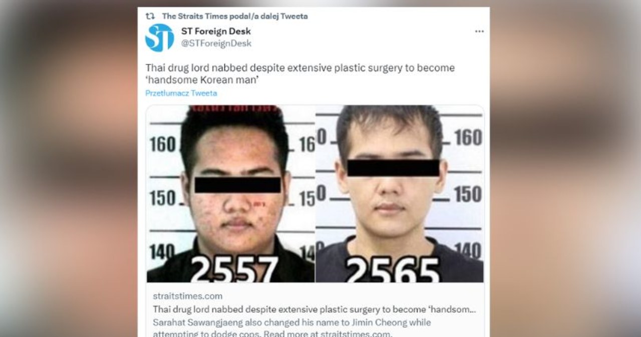 Diler narkotykowy zmienił sobie twarz, żeby uciec policji