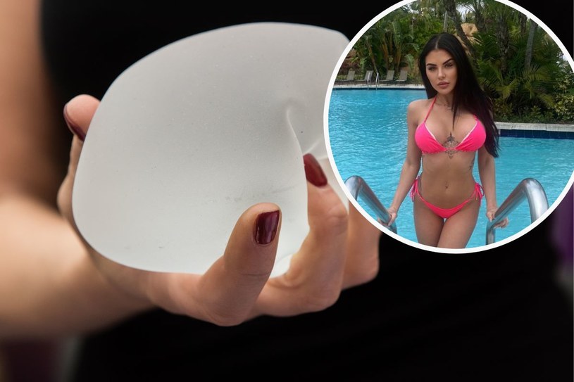 Polska modelka sprzedała swoje implanty za 15 tysięcy! Wszystko za sprawą żartu