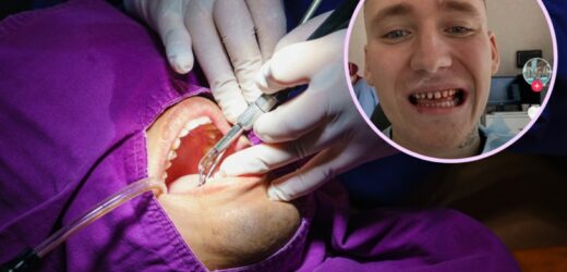 Turecka metamorfoza zębów. Internauci śmieją się z efektu zabiegu