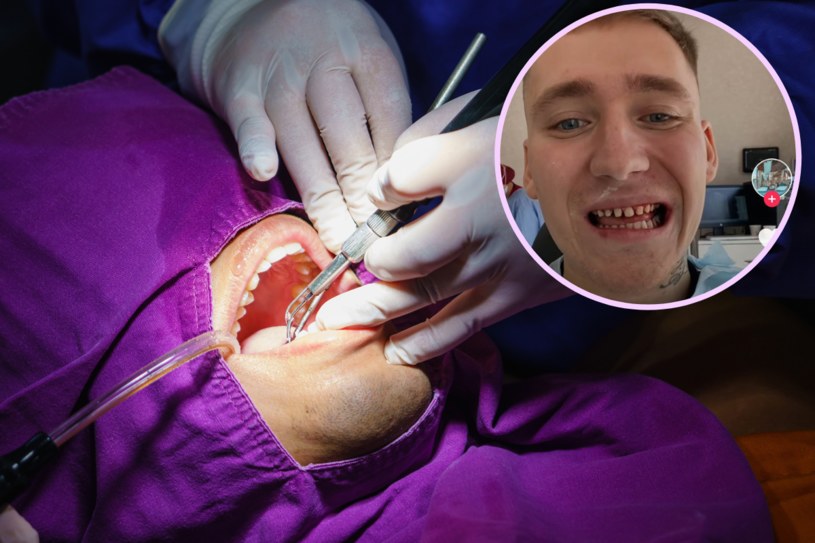 Turecka metamorfoza zębów. Internauci śmieją się z efektu zabiegu