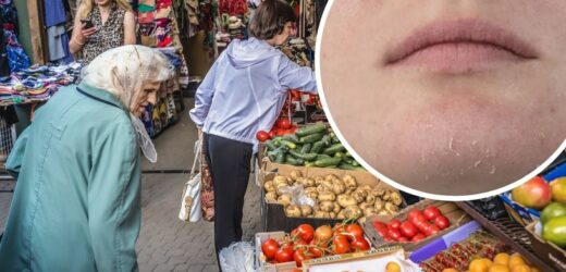 Dieta dla suchej skóry. Co jeść, by skóra była w dobrej kondycji?