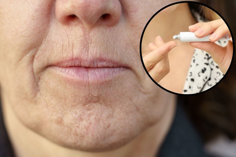 Apteczna maść jak kosmetyk z drogerii. Pomoże nawet na głębokie zmarszczki