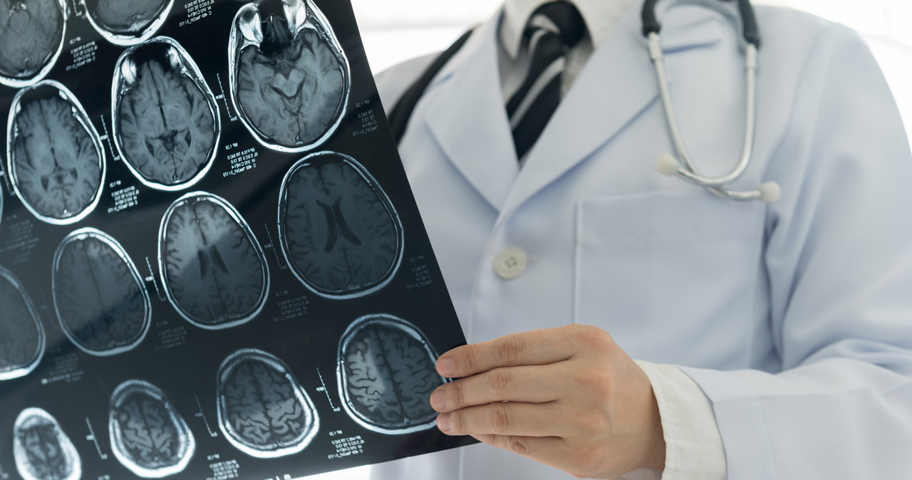 Neurologia w Koszalinie chce wznowić pracę. Lekarze pilnie poszukiwani