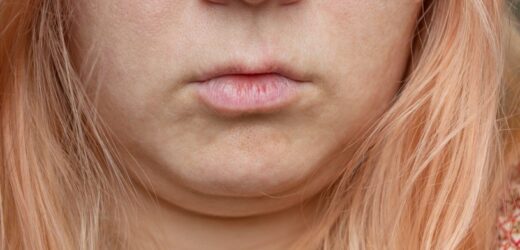 Granica między twarzą a szyją się  zaciera? Obejdzie się bez skalpela
