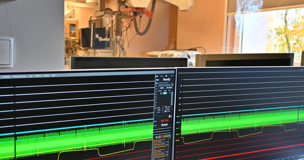 Szpital ma nowoczesny system do diagnostyki i leczenia zaburzeń rytmu serca