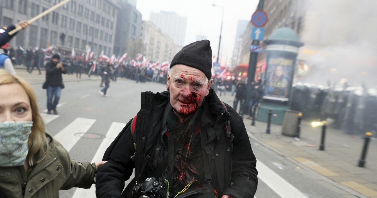 Fotoreporter postrzelony w czasie Marszu Niepodległości. Sąd odrzucił zażalenie