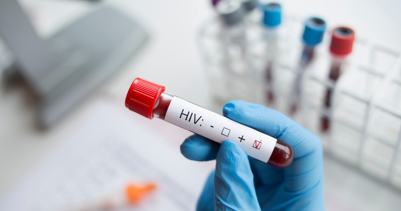 Test jest darmowy, anonimowy i szybki. HIV można leczyć, jeśli zakażenie wykryje się szybko