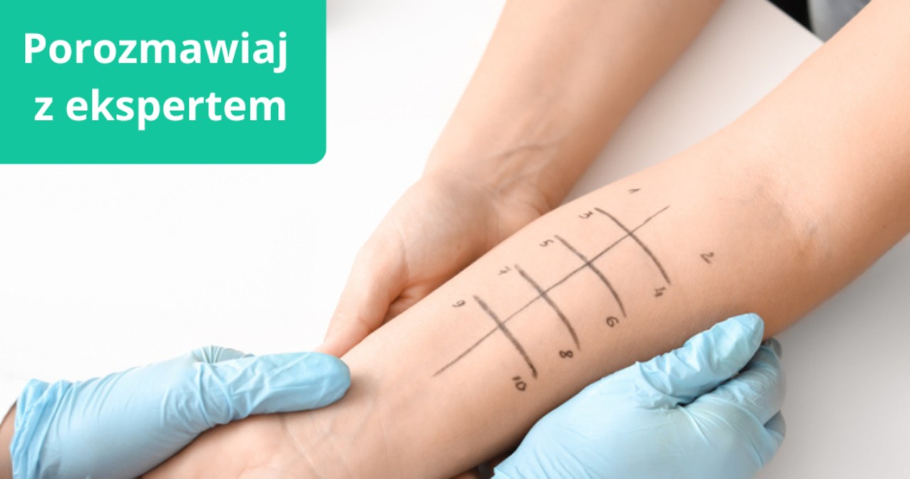 Jak diagnozować alergie?