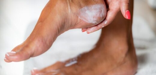 Gładka i powabna skóra pięt w kilka minut. Zmiękczające maski potrafią zdziałać cuda