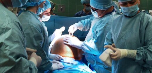 Gigantyczny guz przydatków. Miał 40 cm i ważył ponad 14 kg