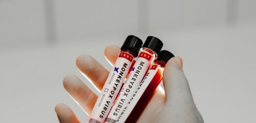 ​Małpia ospa stanowi globalne zagrożenie. Najwyższy alert WHO