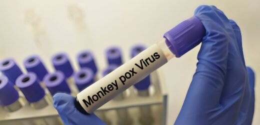 To pierwszy taki przypadek poza Afryką. Nowa odmiana małpiej ospy w Szwecji