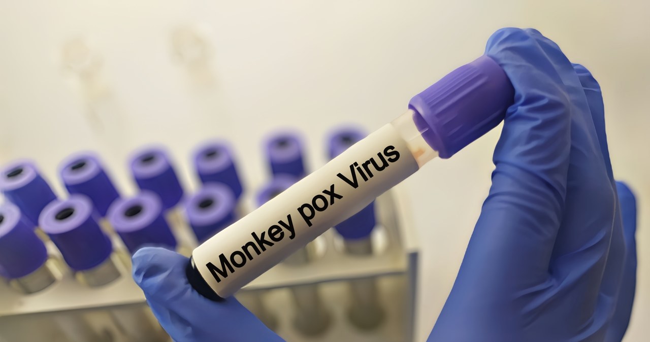 To pierwszy taki przypadek poza Afryką. Nowa odmiana małpiej ospy w Szwecji