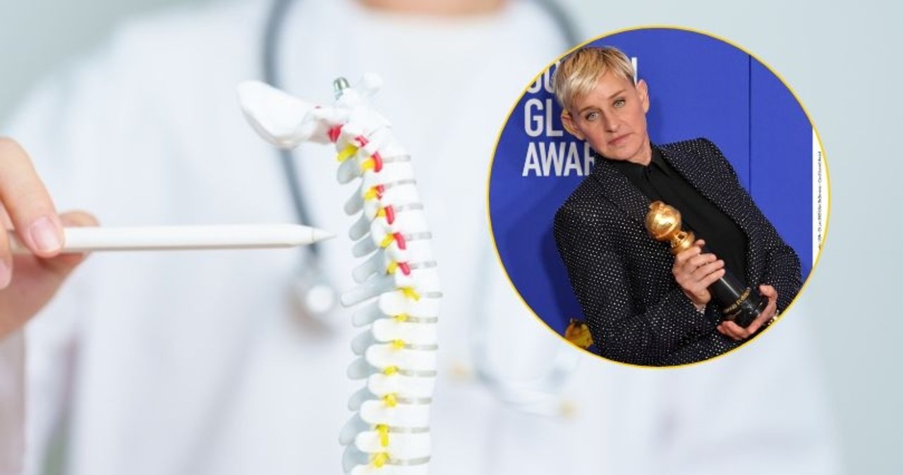 Ellen DeGeneres ma osteoporozę. „To cichy złodziej kości”