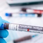 Ten kraj zmaga się z epidemią wirusa Marburg. WHO o ryzyku zakażeń na świecie