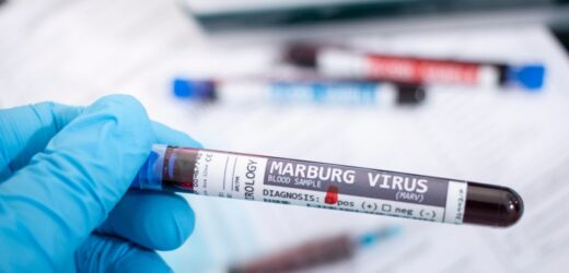 Ten kraj zmaga się z epidemią wirusa Marburg. WHO o ryzyku zakażeń na świecie