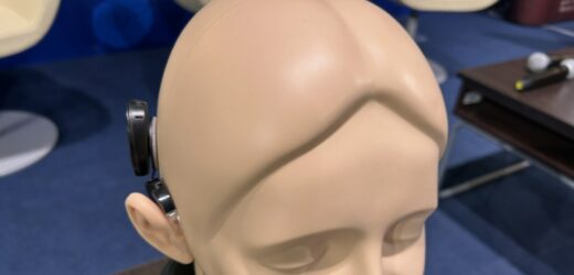 Najmniejszy implant słuchowy na świecie wszczepiony w Polsce