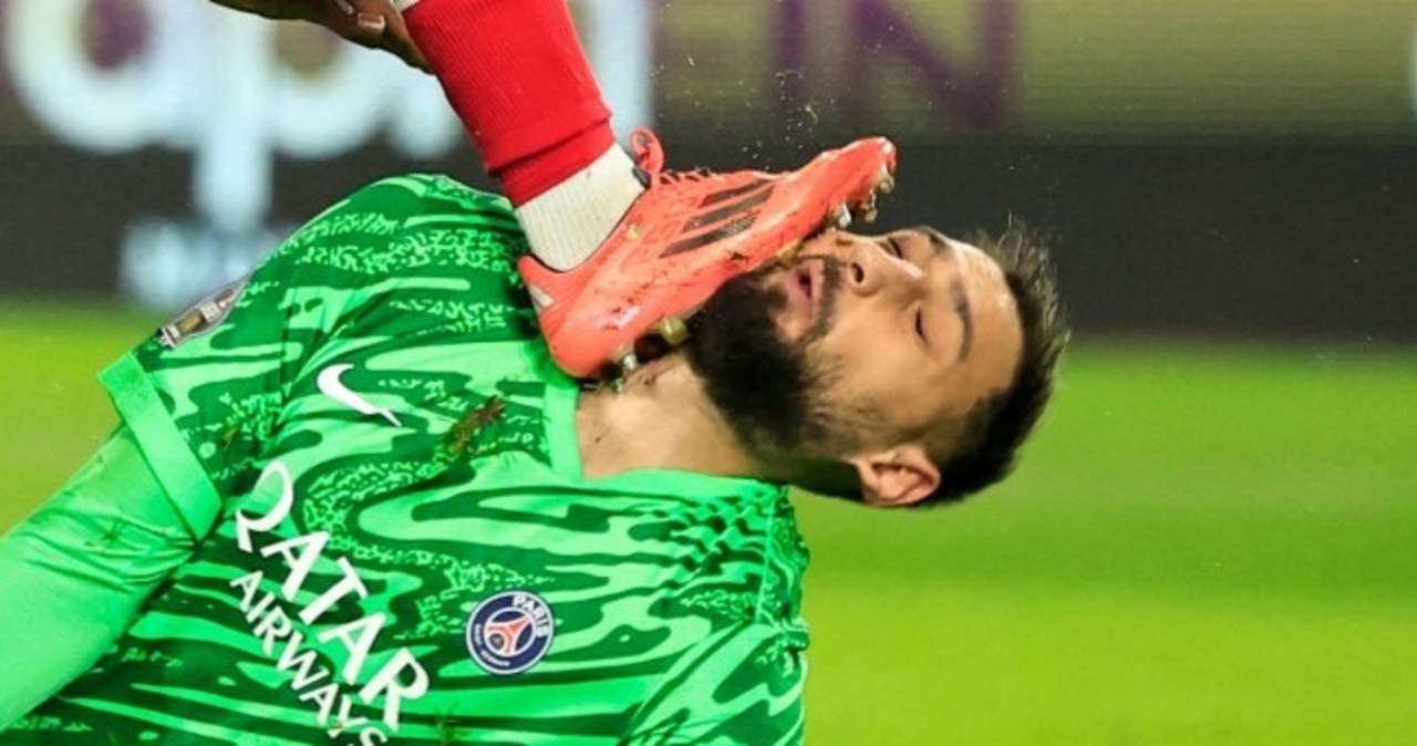 Zmasakrowana twarz Donnarummy. Koszmarna kontuzja gwiazdora