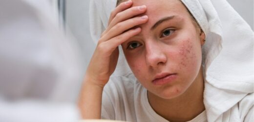 3 codzienne błędy, które sprawiają, że twoja skóra wygląda gorzej