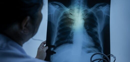 Zimą na tę chorobę umiera nawet 3,5 tys. Polaków w miesiącu