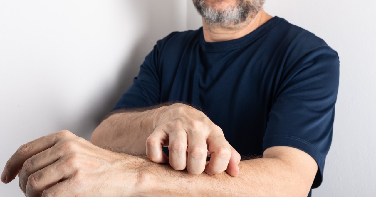 Nie drap się. Serio…