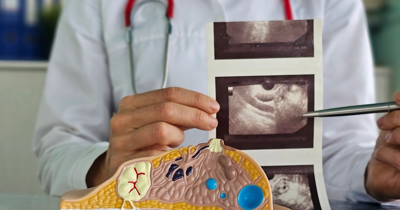 Komórki tłuszczowe mogą zagłodzić raka