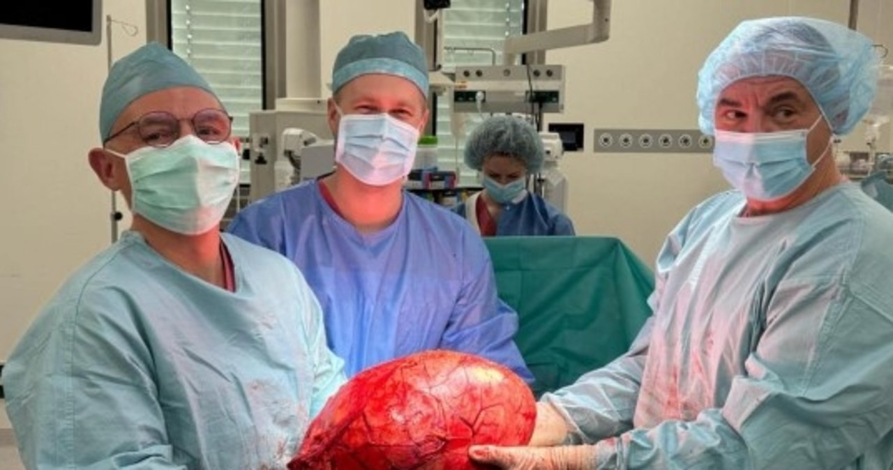 14-kilogramowy guz nerki. Usunęli go lekarze z Gdańska
