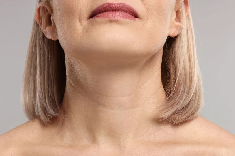 Naszyjnik Wenus niepokoi kobiety. Pojawia się nawet przed trzydziestką